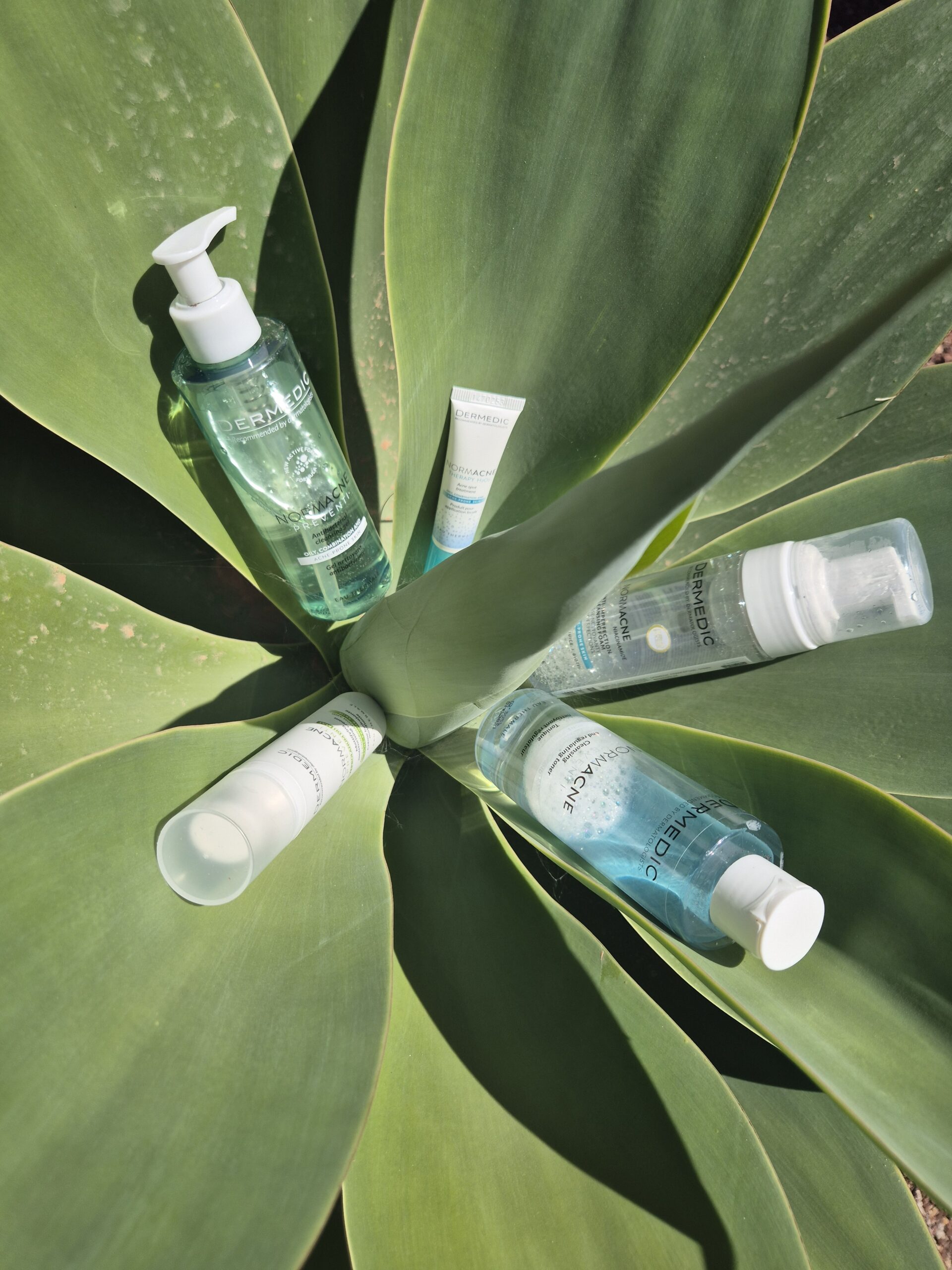 Probleminė oda po 40-ies: dažniausios priežastys ir sprendimai